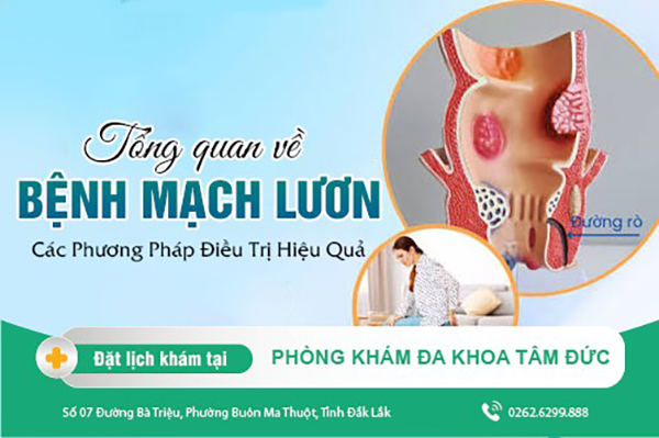 chuyenmuc-img