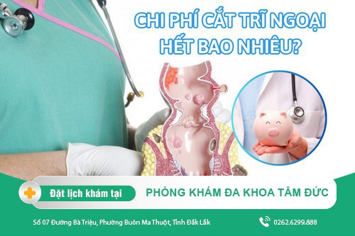 Cắt Trĩ Ngoại Bao Nhiêu Tiền? Cắt Ở Đâu Tốt?