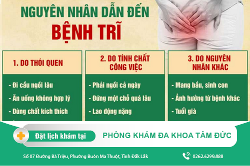 Bệnh Trĩ Là Như Thế Nào? nguyên nhân, triệu chứng và cách điều trị bệnh trĩ hiệu quả